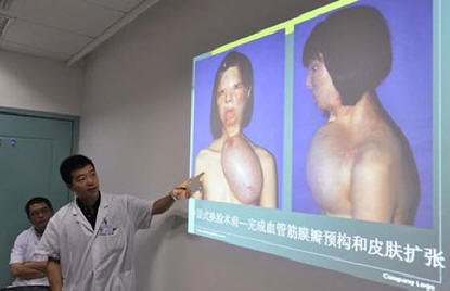 Une autre chirurgie plastique choquante a été effectuée en Chine.
