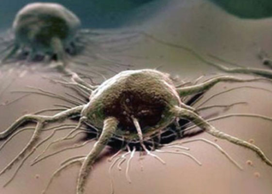 Le cancer est-il la cause d'un accident mortel?