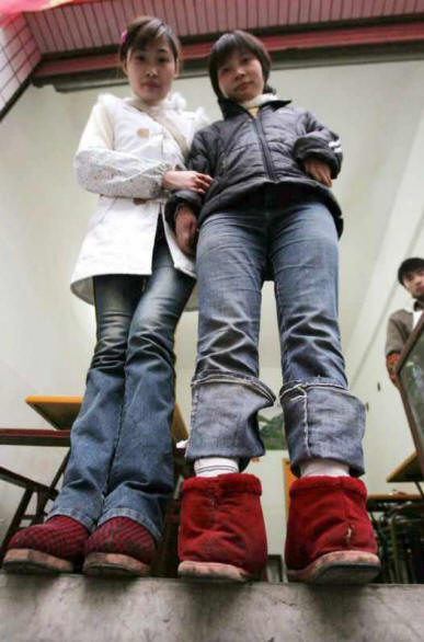 Une femme aux pieds inversés est devenue la serveuse la plus rapide.